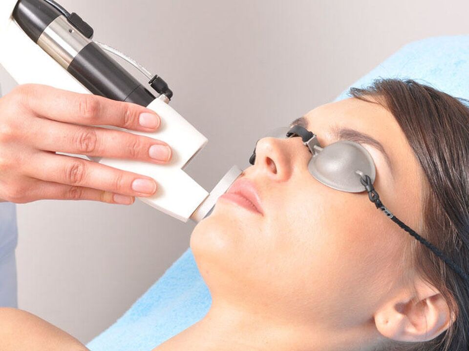 Laser rejuvenation nke anụ ahụ