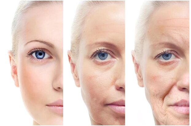 Mwepụ laser nke mgbanwe ndị ọzọ