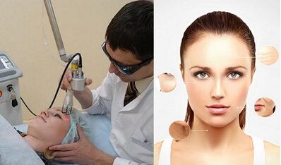 Kedu ka esi eme mmeghari akpụkpọ anụ laser