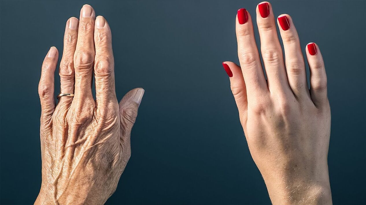 ụzọ dị irè isi mee ka akpụkpọ ahụ dịghachi ọhụrụ