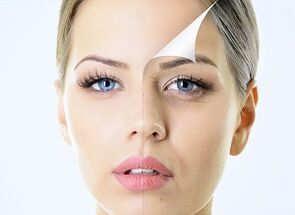 otu esi eme ka akpụkpọ ahụ dị n'akụkụ anya n'ụlọ