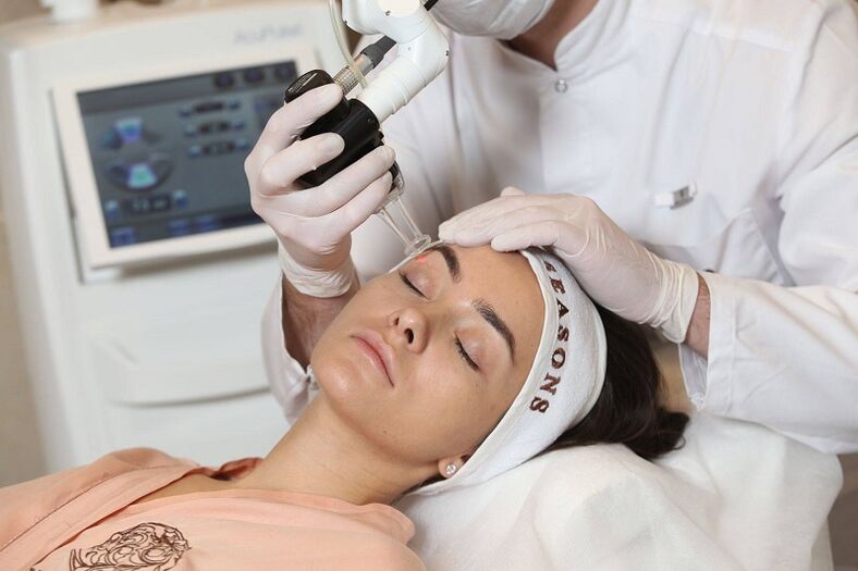 Ntugharị akpụkpọ anụ laser dị nro