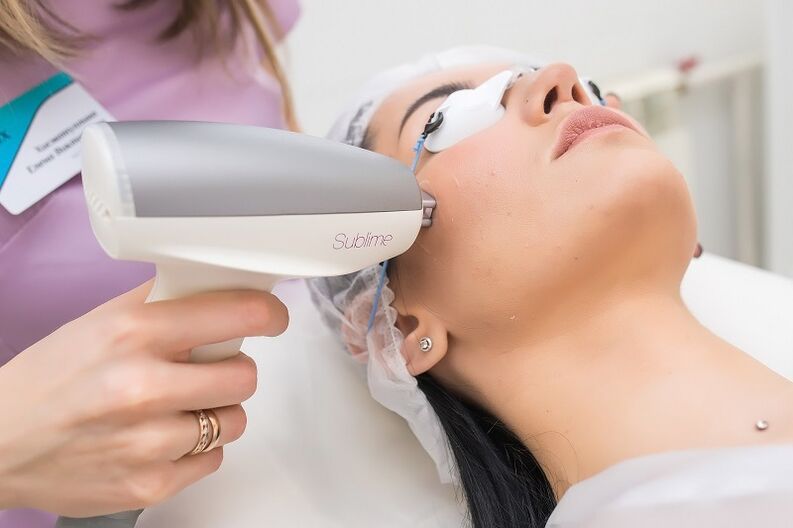 na-eme usoro rejuvenation akpụkpọ anụ laser