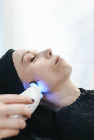 Laser ihu rejuvenation akpụkpọ
