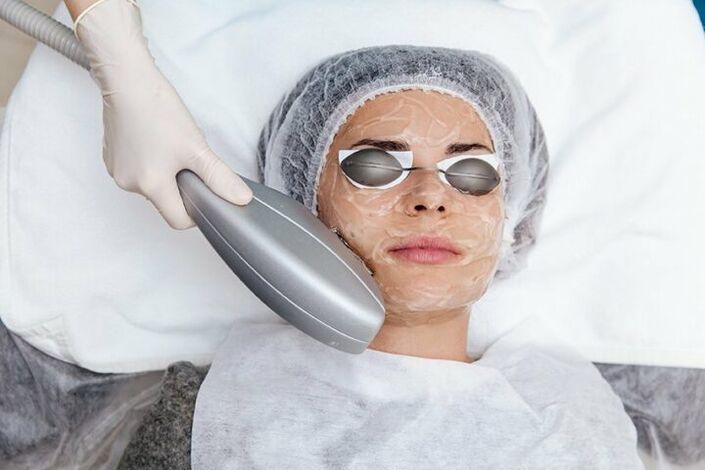 ọgwụgwọ ihu fotorejuvenation mgbochi ịka nká